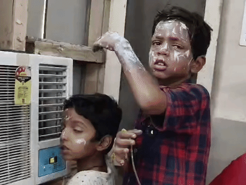 सोनीपत में पटाखा फटने से 3 भाई-बहन झुलसे:जलाते हुए आवाज नहीं आई तो देखने गए, अचानक फटा; खेलते समय मिला था