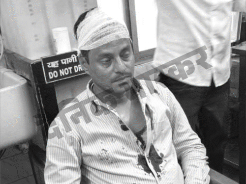 पटना में STF इंस्पेक्टर पर हेलमेट से हमला, सिर फटा:हिरासत में बीजेपी नेता, कार ने इंस्पेक्टर की बाइक को मारी थी टक्कर; विवाद के बाद हमला