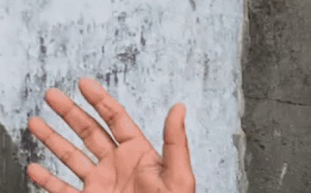 सांप ने काटा तो उसे लेकर अस्पताल पहुंचा व्यक्ति:सोनीपत में डॉक्टर की टेबल पर रख बोला- मुझे इसने डसा, इलाज करो; अफरातफरी मची