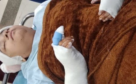 ससुर ने बहू पर फरसे से हमला किया:खाने में देरी पर हुआ विवाद, पड़ोसी ने बचाया