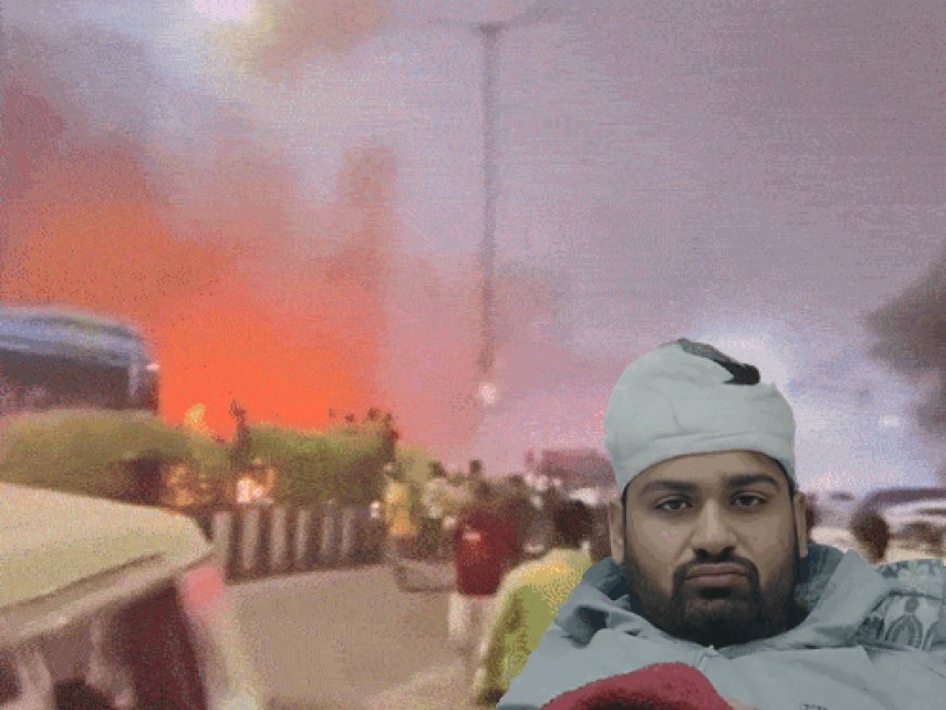 दिल्ली ब्लास्ट में घायल उत्तराखंड का युवक पहुंचा घर:मां बोली- शादी की शॉपिंग कर लौट रहे थे, अचानक धमाके से चारों तरफ आग लगी