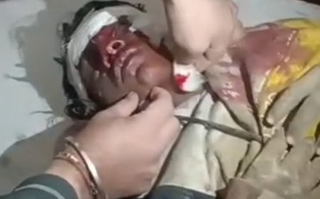 डबवाली में युवक पर सांड ने किया हमला, हालत गंभीर:लघुशंका के लिए खेत में जा रहा था; सींग और मुंह से किए वार