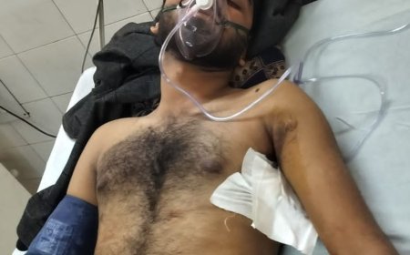 अयोध्या में बीएससी छात्र पर चाकू से ताबड़तोड़ हमला:बर्थडे पार्टी में पुरानी रंजिश में वारदात, गंभीर हालत में KGMU में भर्ती; आरोपियों की तलाश जारी