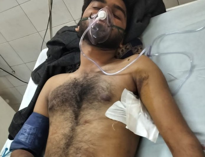 अयोध्या में बीएससी छात्र पर चाकू से ताबड़तोड़ हमला:बर्थडे पार्टी में पुरानी रंजिश में वारदात, गंभीर हालत में KGMU में भर्ती; आरोपियों की तलाश जारी