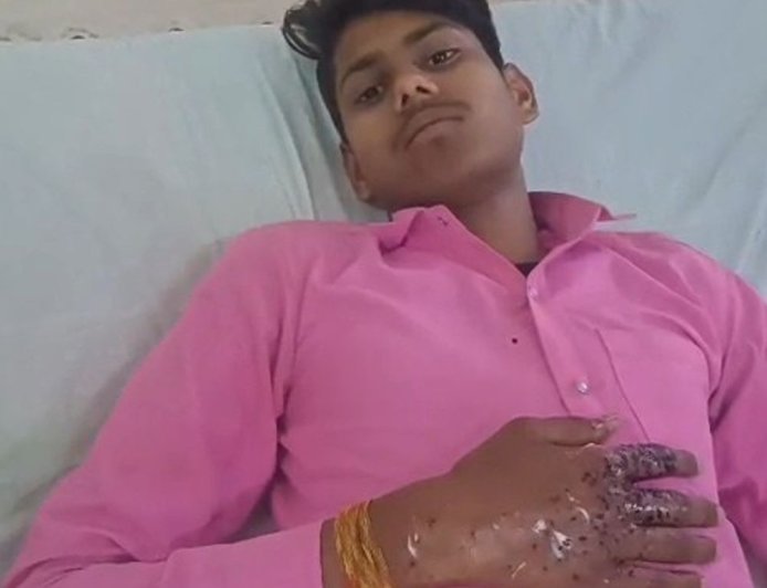 उन्नाव में युवक पर फायरिंग, मुख्य आरोपी गिरफ्तार:मुंबई में साथ में बनाते थे रील्स, 3 साथियों संग पकड़ा गया