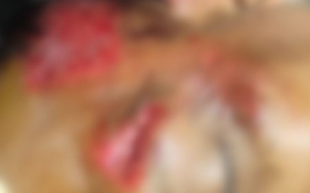 फरीदाबाद में कार ने पुलिसकर्मी को मारी टक्कर:सिर में लगी गंभीर चोट, आरोपी युवक फरार; पुलिस मामले की जांच में जुटी