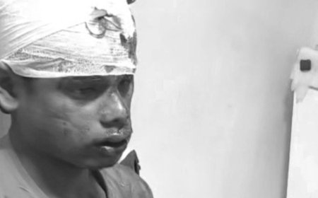 पंचकूला में शिमला हाईवे पर पलटी स्कूटी:अचानक बिगड़ा संतुलन, 4 युवक घायल, तीन की हालत नाजुक, हायर सेंटर रेफर