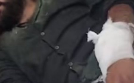 दिल्ली में मिक्सर-ग्राइंडर से हलवाई के हाथ काटने की कोशिश:शादी के बकाया पैसे मांगने गया था; छत पर बांधकर पीटा; दो नाबालिग भी गिरफ्तार