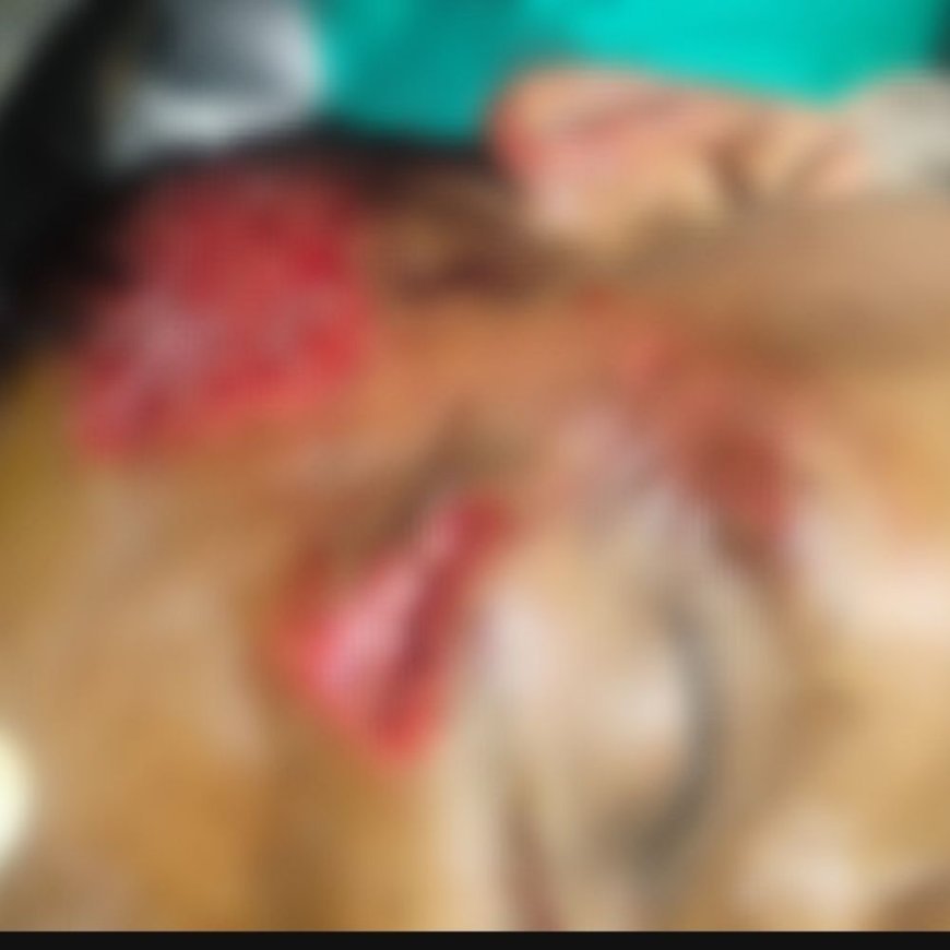 फरीदाबाद में कार ने पुलिसकर्मी को मारी टक्कर:सिर में लगी गंभीर चोट, आरोपी युवक फरार; पुलिस मामले की जांच में जुटी