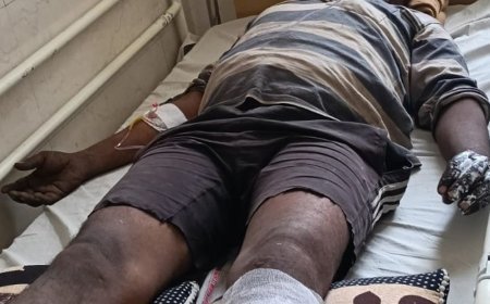पानीपत में गर्म राख के गड्ढे में गिरा रिक्शा ड्राइवर:दोनों पैर और एक हाथ बुरी तरह झुलसे; शौच के लिए रुका था