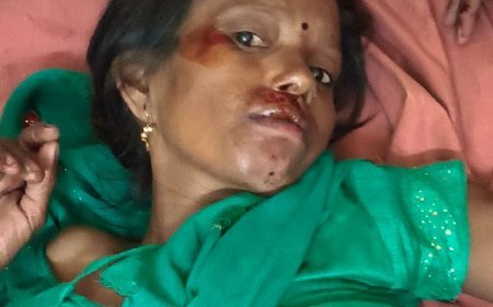 उन्नाव में अज्ञात वाहन की टक्कर से महिला की मौत:लखनऊ-बांगरमऊ मार्ग पर 2 लोग गंभीर घायल, चालक की तलाश जारी