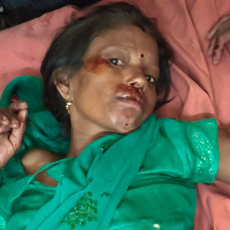 उन्नाव में अज्ञात वाहन की टक्कर से महिला की मौत:लखनऊ-बांगरमऊ मार्ग पर 2 लोग गंभीर घायल, चालक की तलाश जारी