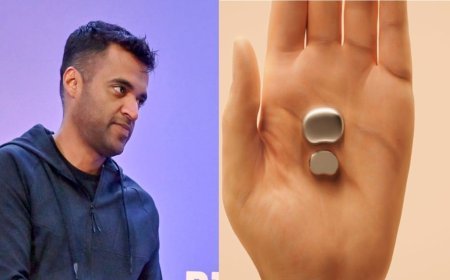 Deepinder Goyal ने Temple Device की डिलीवरी पर दी बड़ी अपडेट, Health Tech सेक्टर में मचेगी हलचल